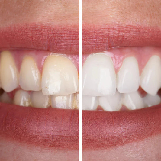 Dentifrice violet